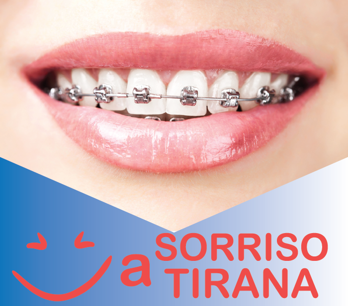 SORRISO A TIRANA